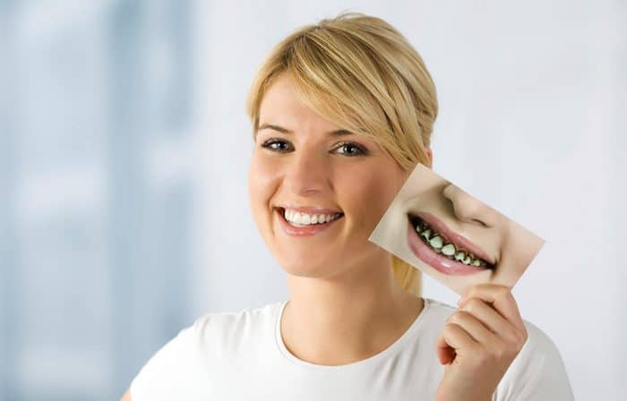 Connect with the Best Dental Treatment Abroad | Dental Treatment Abroad