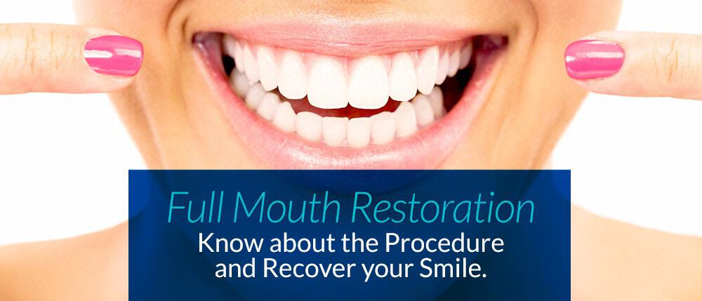 affordable Full mouth restoration